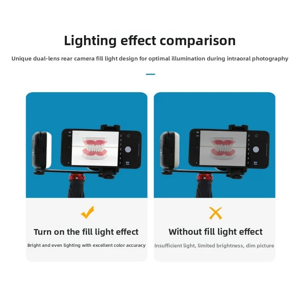 Dental Photography Light, Blue - огляд і ціна Photography Lighting Kit Portable